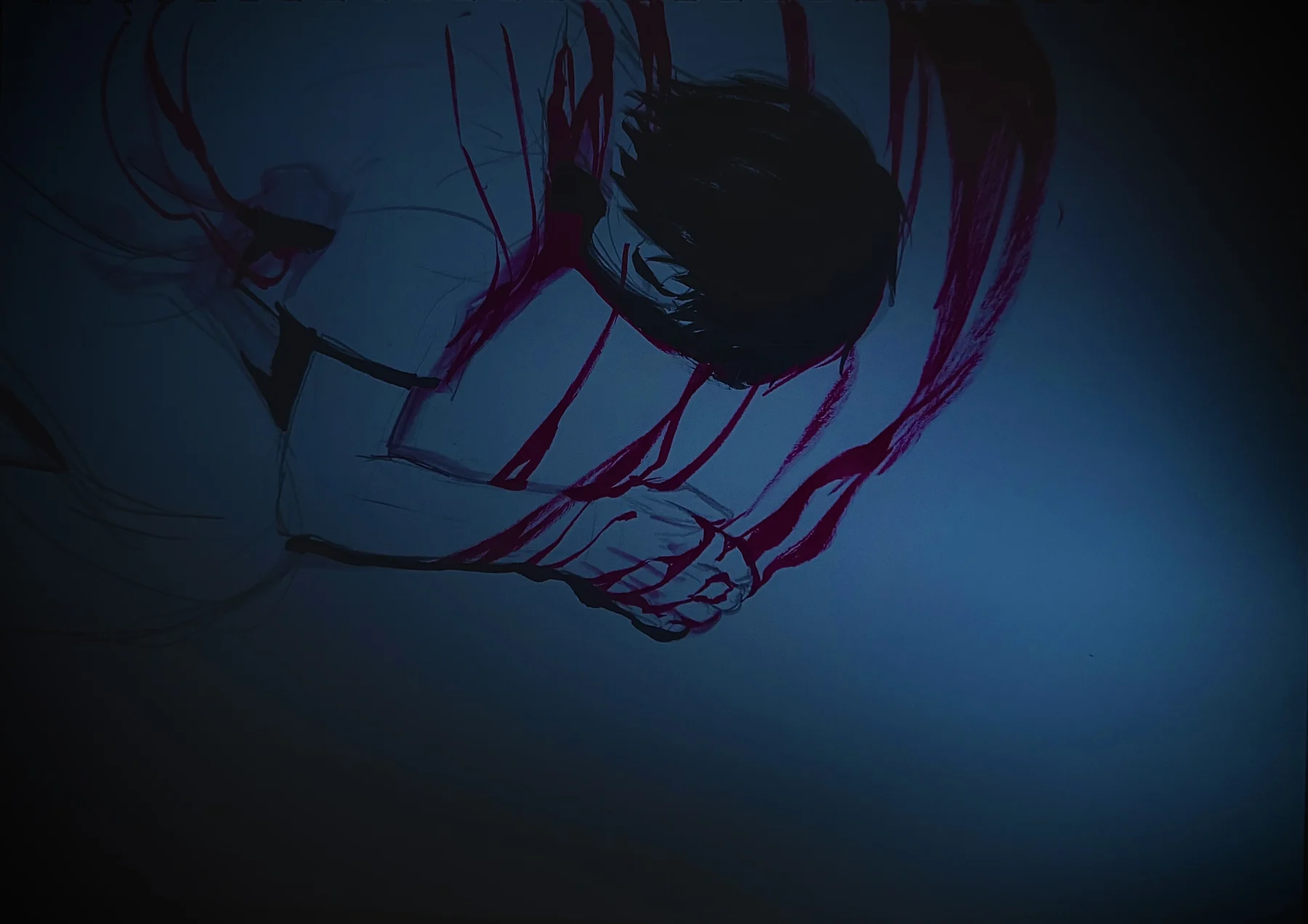 鈍痛
